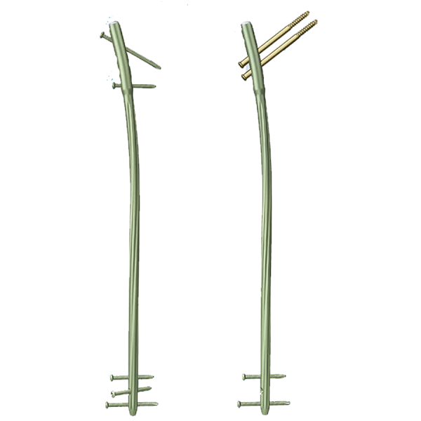 Clavo centromedular de reconstruccion para femur EXPERT LFN