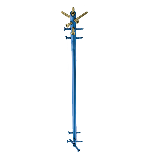 Clavo centromedular de tibia EXPERT